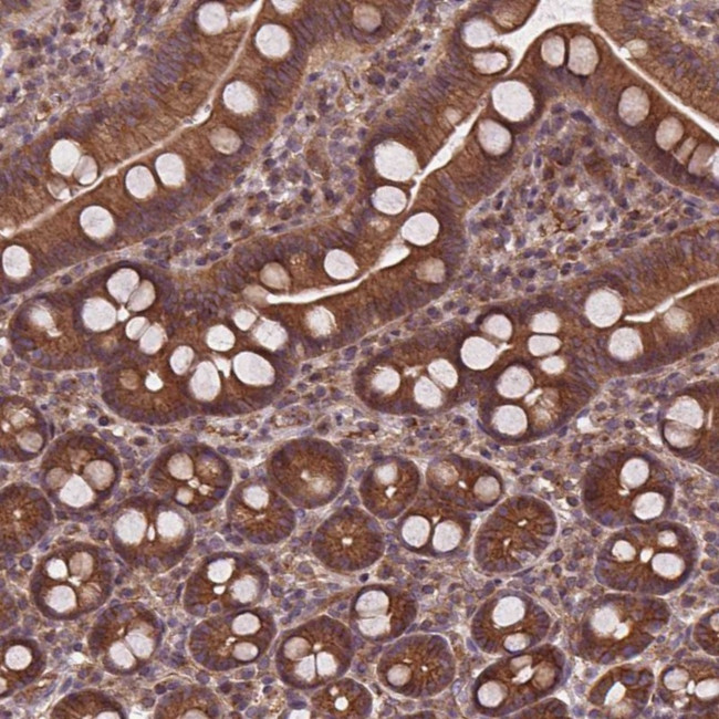 ENTH Antibody in Immunohistochemistry (Paraffin) (IHC (P))