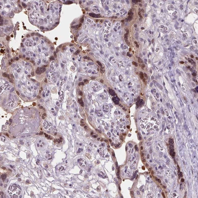 C2orf16 Antibody in Immunohistochemistry (Paraffin) (IHC (P))