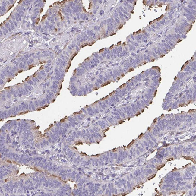 RUNDC3B Antibody in Immunohistochemistry (Paraffin) (IHC (P))