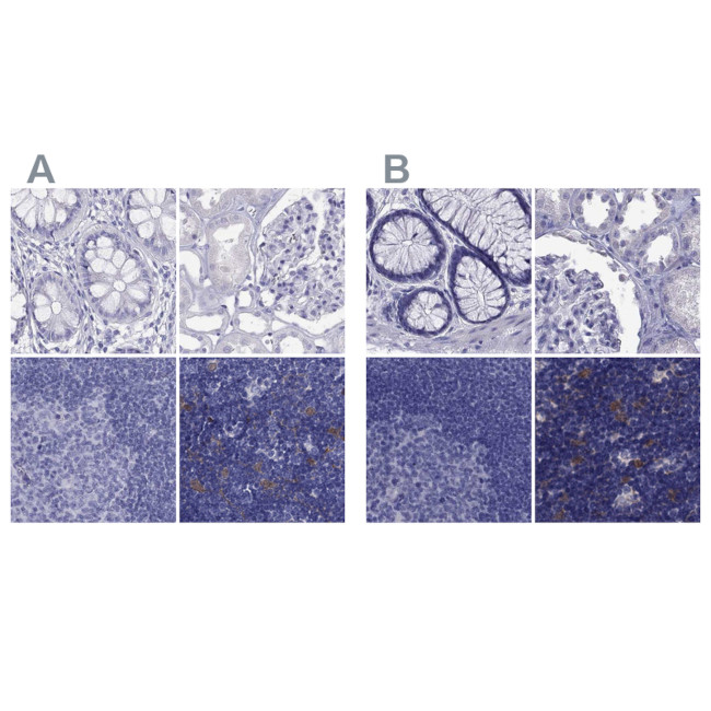 PSMB11 Antibody in Immunohistochemistry (IHC)