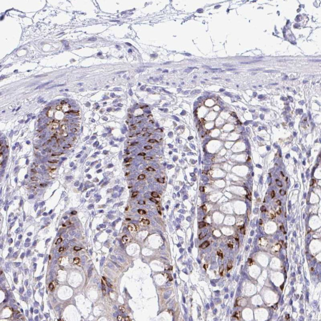 NALP8 Antibody in Immunohistochemistry (Paraffin) (IHC (P))