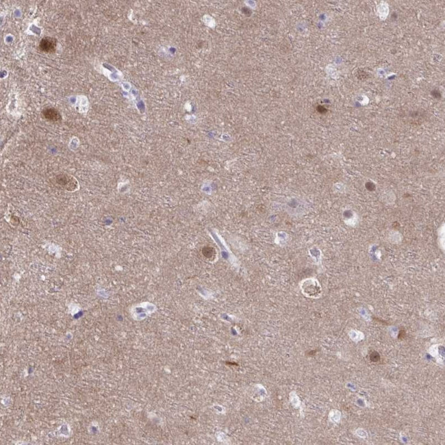 PGM2L1 Antibody in Immunohistochemistry (Paraffin) (IHC (P))
