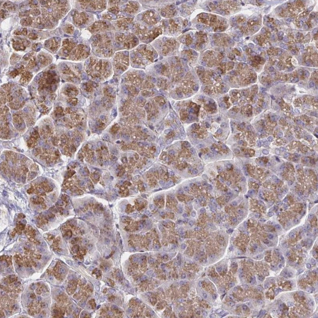 CCDC85A Antibody in Immunohistochemistry (Paraffin) (IHC (P))
