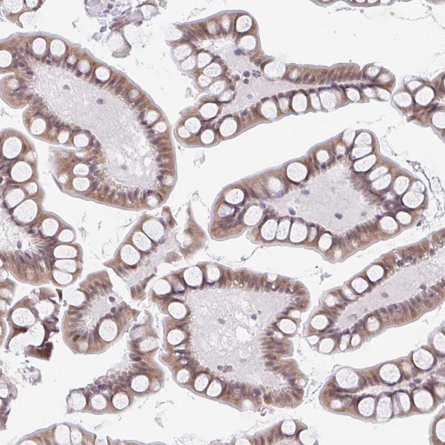 SLC7A10 Antibody in Immunohistochemistry (Paraffin) (IHC (P))