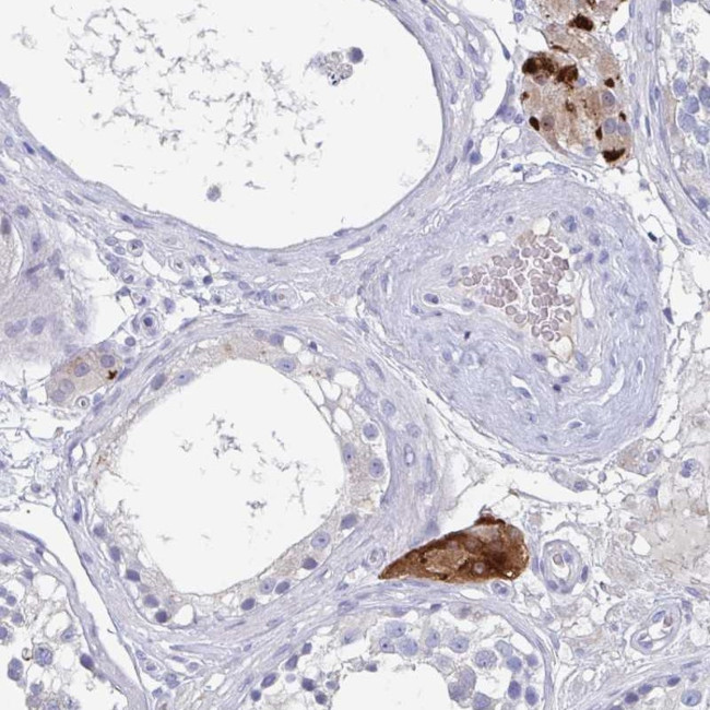 NT5C3B Antibody in Immunohistochemistry (Paraffin) (IHC (P))