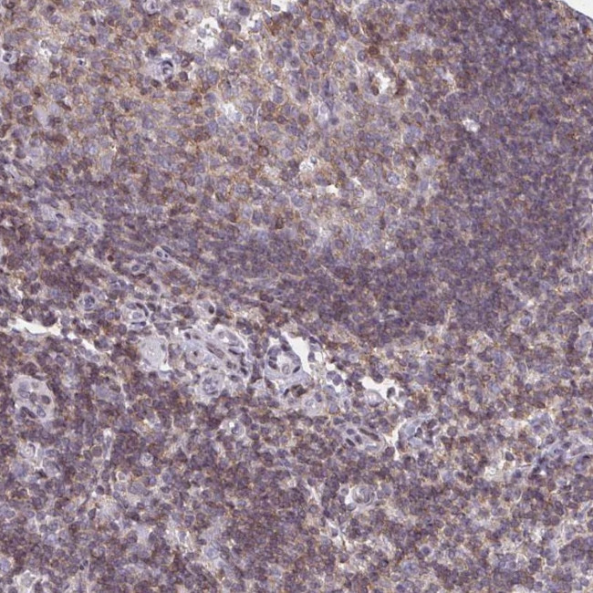 AP5M1 Antibody in Immunohistochemistry (Paraffin) (IHC (P))