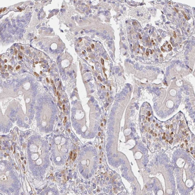 SSH2 Antibody in Immunohistochemistry (Paraffin) (IHC (P))