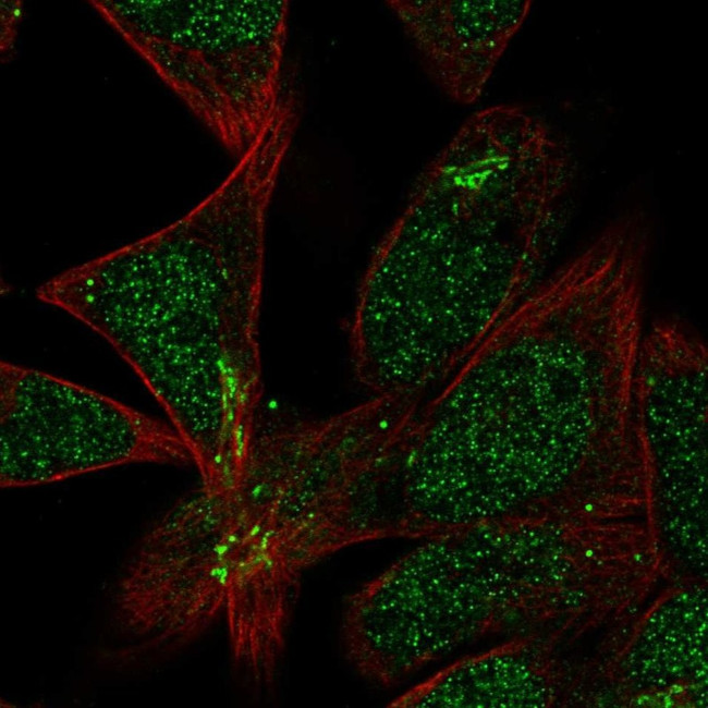 TMEM86A Antibody in Immunocytochemistry (ICC/IF)