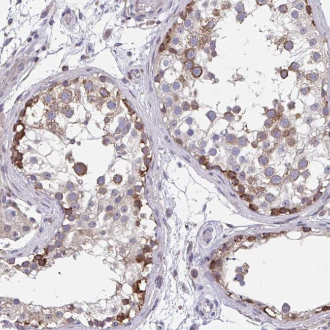 ZNF778 Antibody in Immunohistochemistry (IHC)