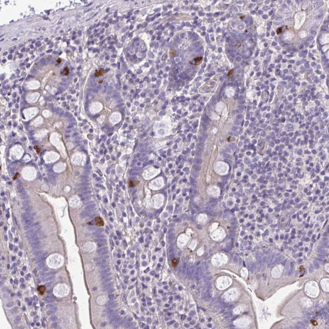 RUNDC3B Antibody in Immunohistochemistry (Paraffin) (IHC (P))
