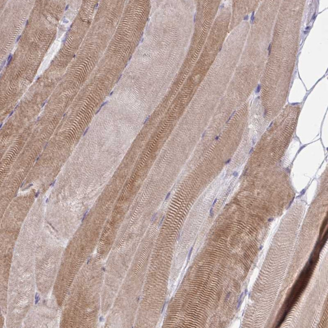 ZNF498 Antibody in Immunohistochemistry (Paraffin) (IHC (P))