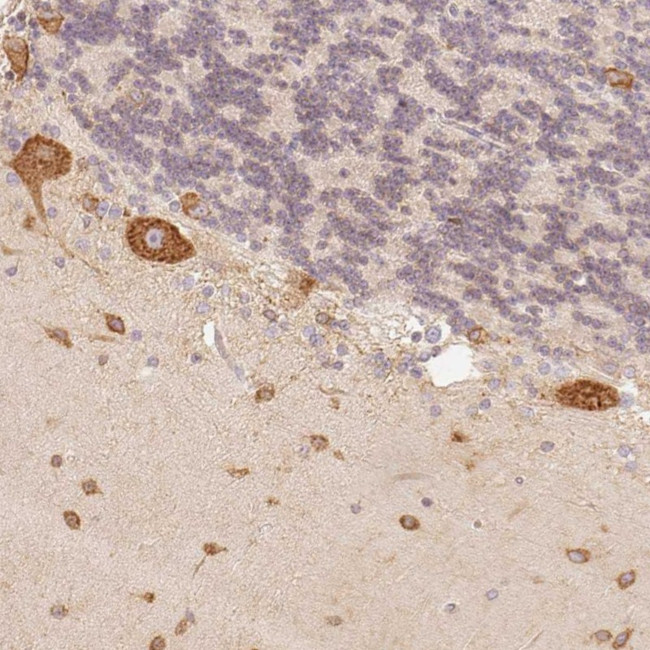 FAM189A2 Antibody in Immunohistochemistry (Paraffin) (IHC (P))