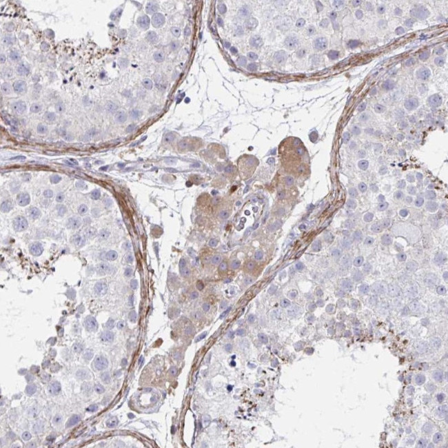 FBXL13 Antibody in Immunohistochemistry (Paraffin) (IHC (P))