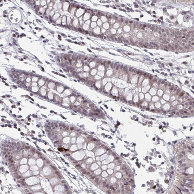 SETBP1 Antibody in Immunohistochemistry (Paraffin) (IHC (P))
