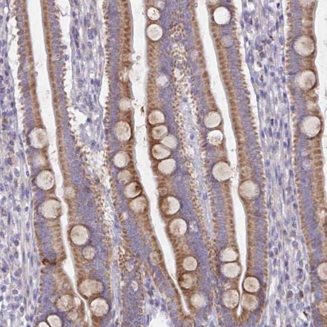 MRPS2 Antibody in Immunohistochemistry (IHC)