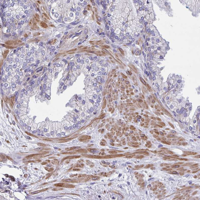 SARDH Antibody in Immunohistochemistry (Paraffin) (IHC (P))