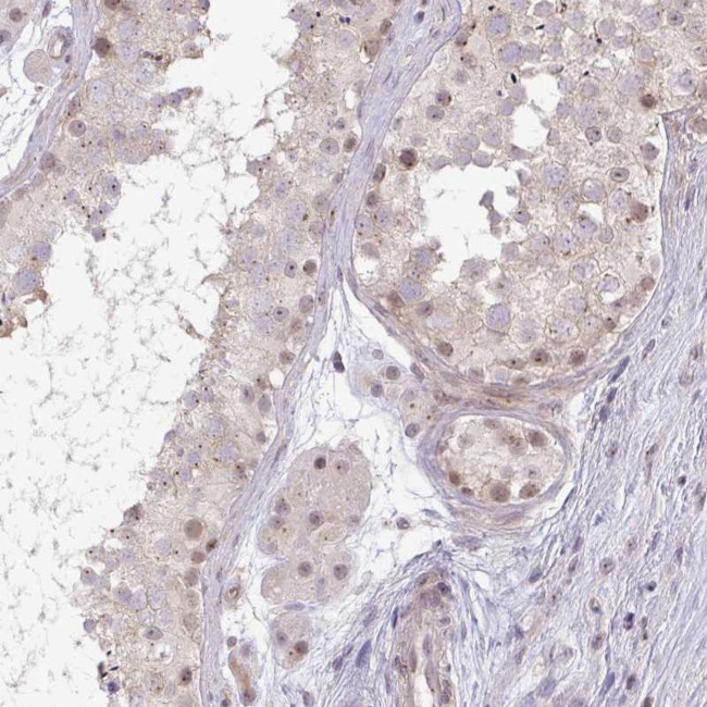 DZIP1 Antibody in Immunohistochemistry (Paraffin) (IHC (P))