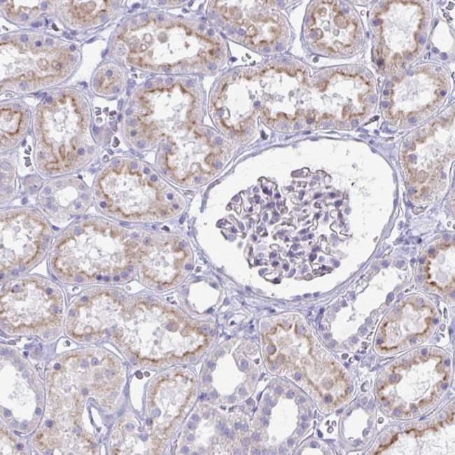 IGSF5 Antibody in Immunohistochemistry (Paraffin) (IHC (P))