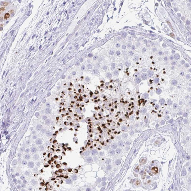 RLF Antibody in Immunohistochemistry (Paraffin) (IHC (P))