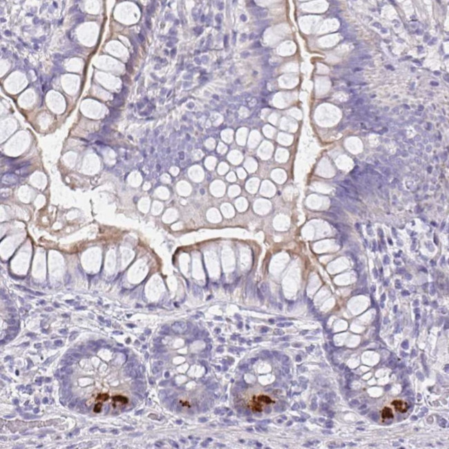 FBXO47 Antibody in Immunohistochemistry (Paraffin) (IHC (P))