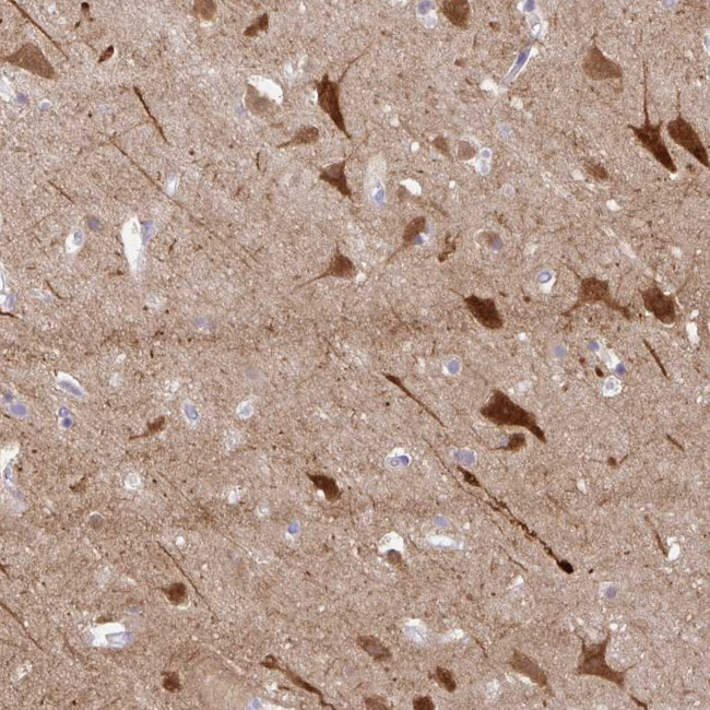 OR4N4 Antibody in Immunohistochemistry (Paraffin) (IHC (P))