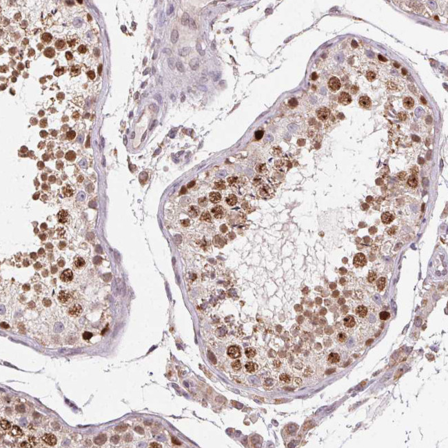 PIWIL4 Antibody in Immunohistochemistry (Paraffin) (IHC (P))