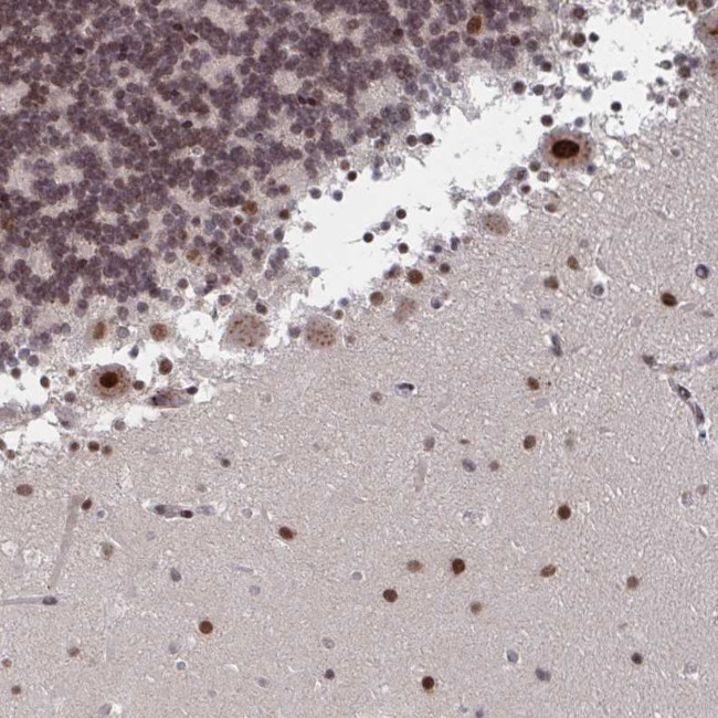 RNF212 Antibody in Immunohistochemistry (Paraffin) (IHC (P))