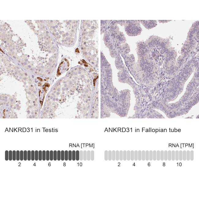 ANKRD31 Antibody in Immunohistochemistry (IHC)
