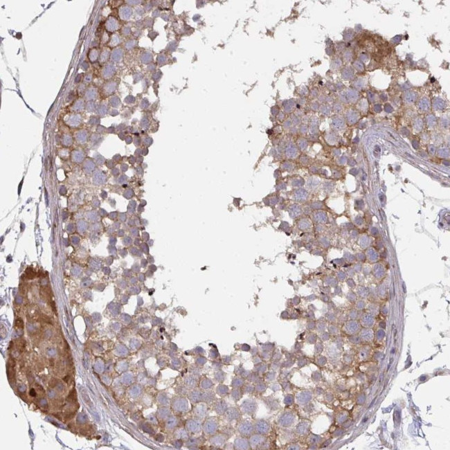 ZFYVE28 Antibody in Immunohistochemistry (Paraffin) (IHC (P))