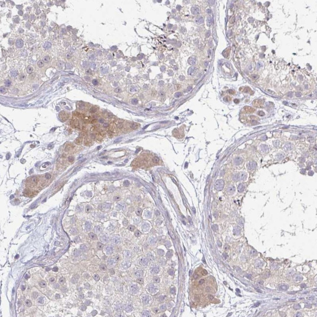 C10orf90 Antibody in Immunohistochemistry (Paraffin) (IHC (P))