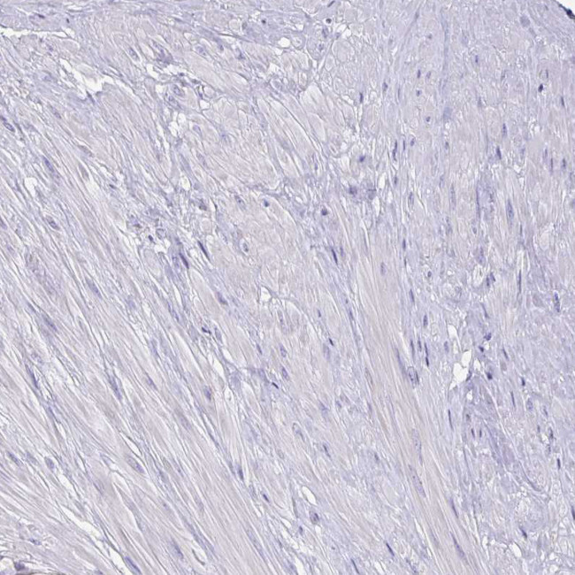 YARS2 Antibody in Immunohistochemistry (Paraffin) (IHC (P))