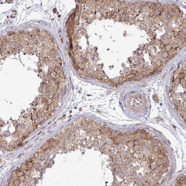 TRIM44 Antibody in Immunohistochemistry (Paraffin) (IHC (P))