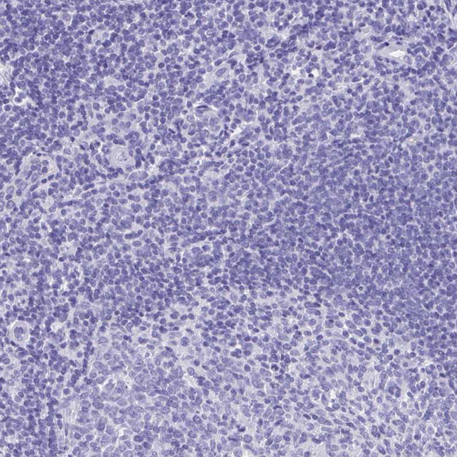 MS4A12 Antibody in Immunohistochemistry (Paraffin) (IHC (P))
