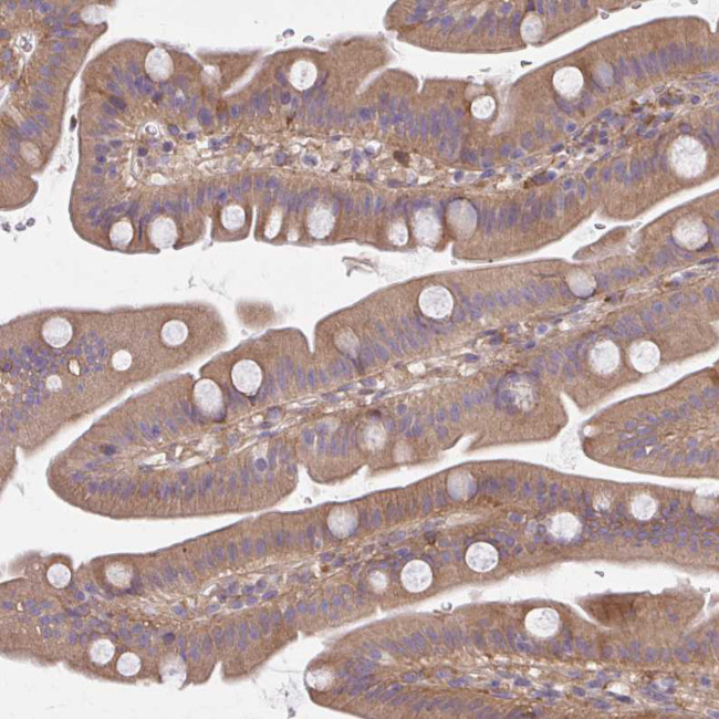CEMP1 Antibody in Immunohistochemistry (Paraffin) (IHC (P))