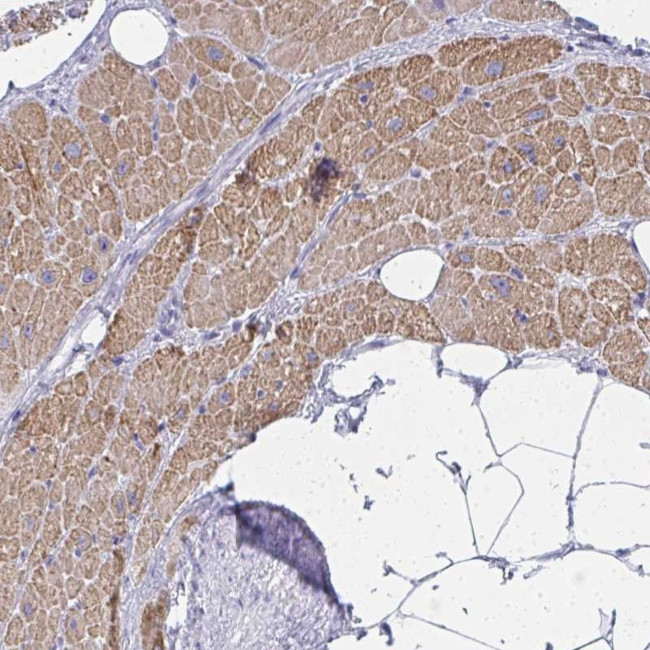 ZNF805 Antibody in Immunohistochemistry (Paraffin) (IHC (P))