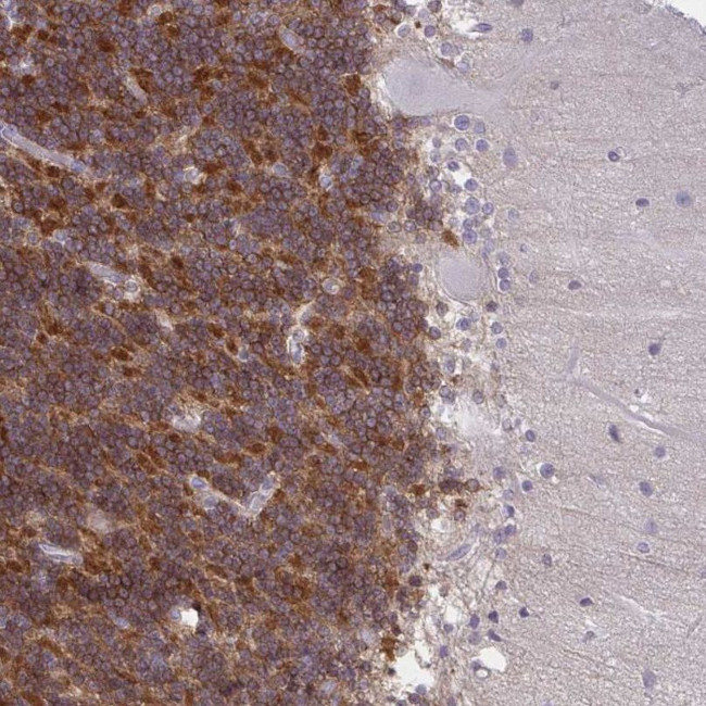 GPRIN3 Antibody in Immunohistochemistry (IHC)