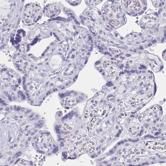 RNF183 Antibody in Immunohistochemistry (Paraffin) (IHC (P))