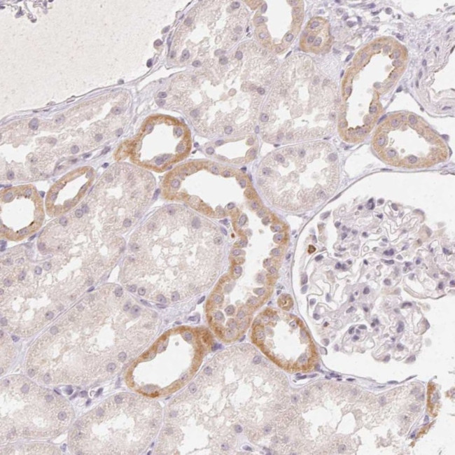 CLCNKA Antibody in Immunohistochemistry (Paraffin) (IHC (P))