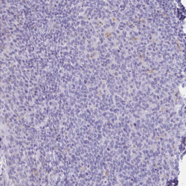 Lymphotactin Antibody in Immunohistochemistry (Paraffin) (IHC (P))