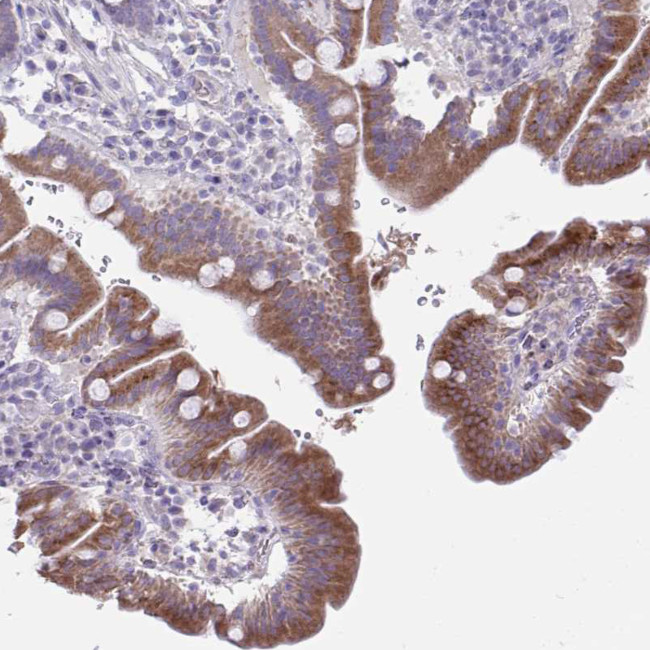 PLA2G12B Antibody in Immunohistochemistry (Paraffin) (IHC (P))