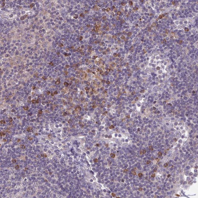 CD1e Antibody in Immunohistochemistry (Paraffin) (IHC (P))