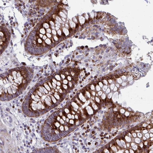 OLFM2 Antibody in Immunohistochemistry (Paraffin) (IHC (P))