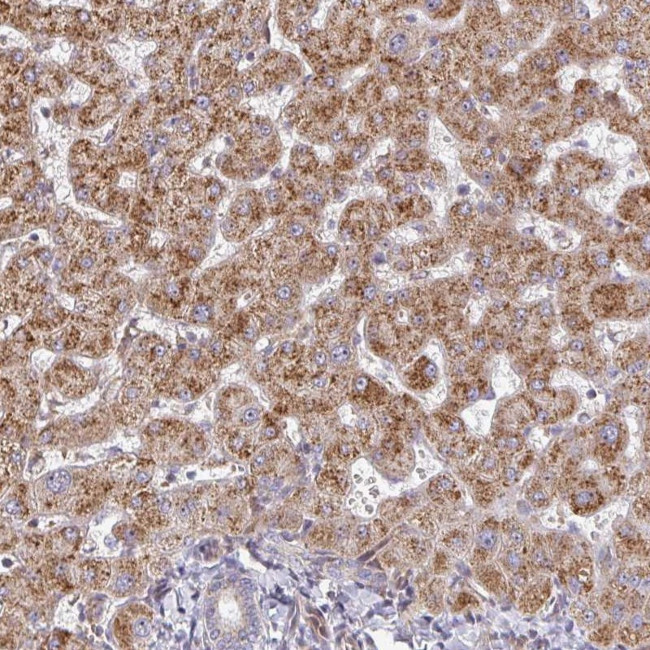 ZNF644 Antibody in Immunohistochemistry (Paraffin) (IHC (P))