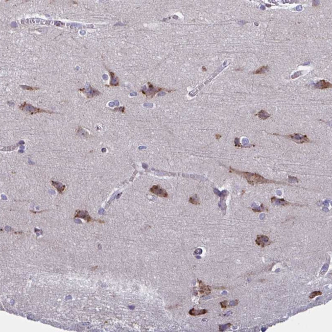 C19orf35 Antibody in Immunohistochemistry (Paraffin) (IHC (P))