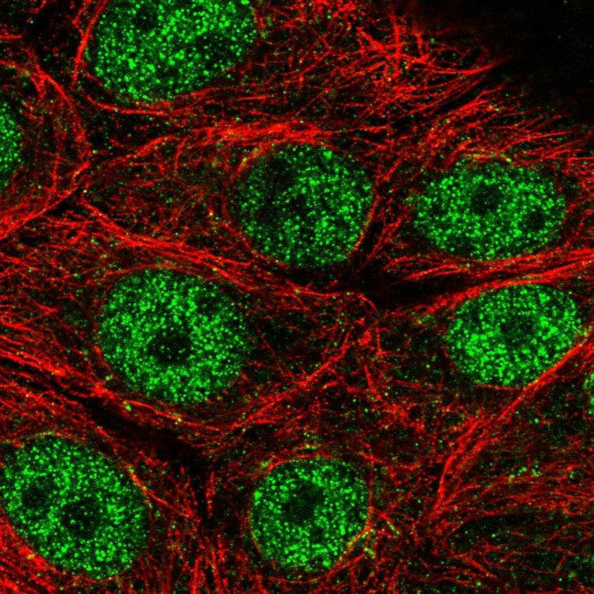 MORN2 Antibody in Immunocytochemistry (ICC/IF)
