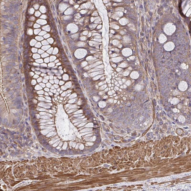 ZNF696 Antibody in Immunohistochemistry (Paraffin) (IHC (P))