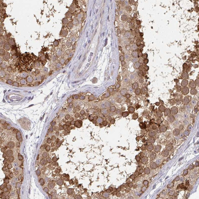 RANGRF Antibody in Immunohistochemistry (Paraffin) (IHC (P))
