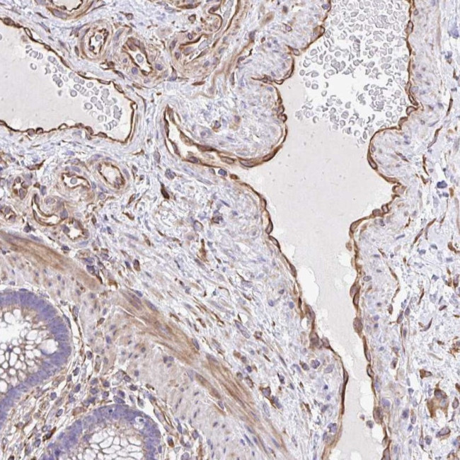 KF1 Antibody in Immunohistochemistry (Paraffin) (IHC (P))