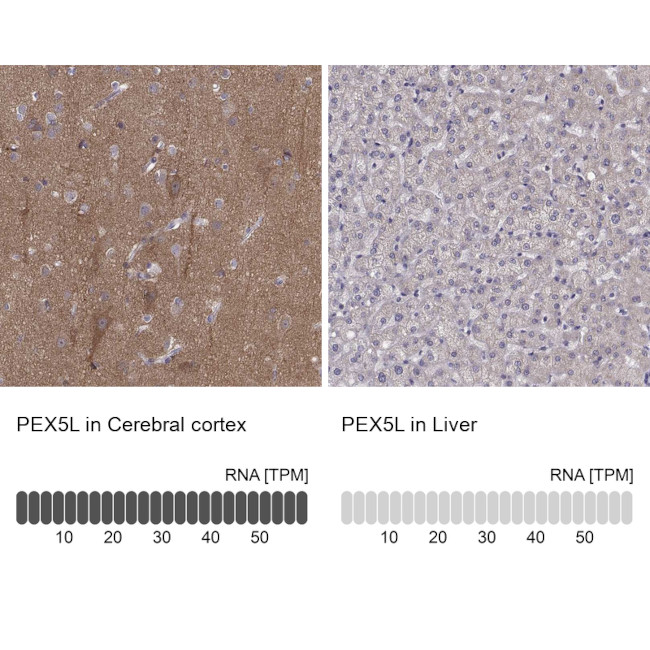 PEX5L Antibody in Immunohistochemistry (IHC)