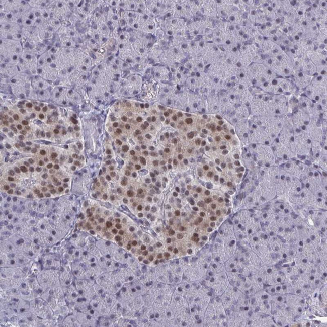 BCL7B Antibody in Immunohistochemistry (Paraffin) (IHC (P))